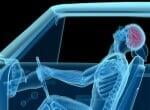 x-ray picture of a body's skeleton in a car with the neck tilted back
